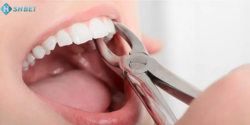 Mơ nhổ răng tốt hay xấu không?